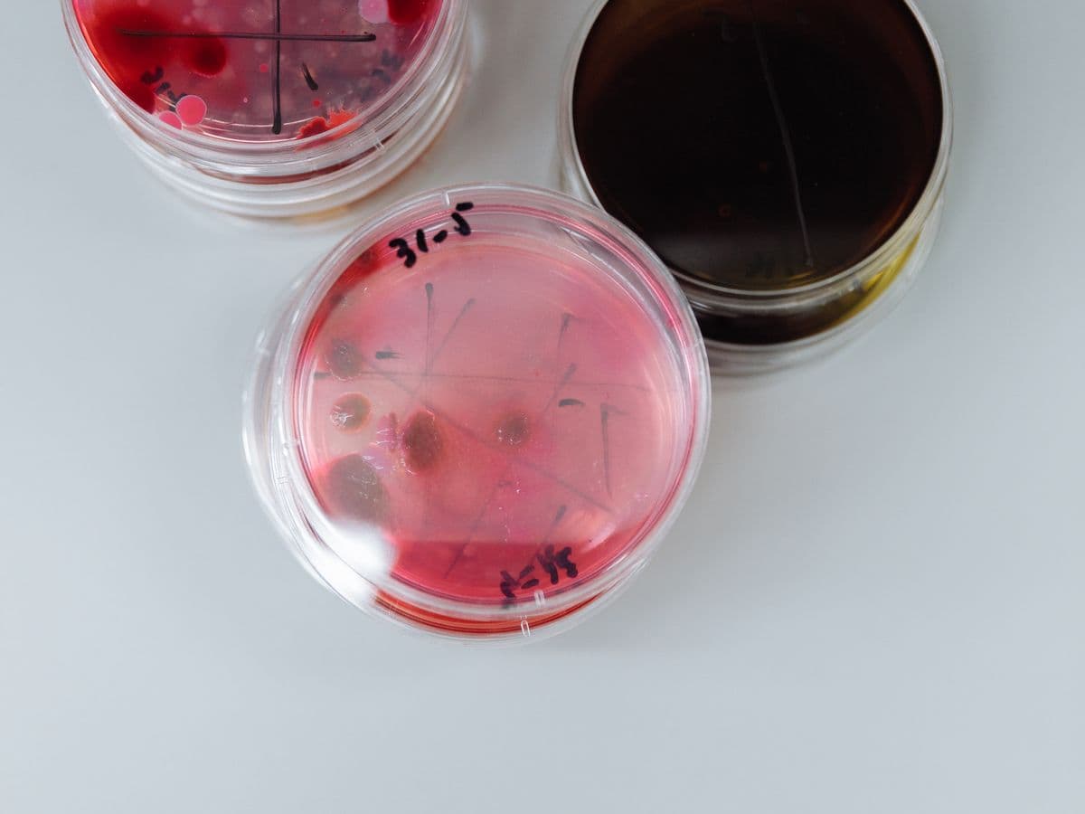 MacConkey Agar